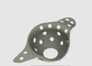 Acetabular cage